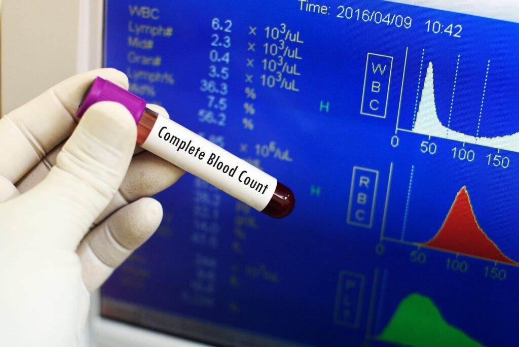 Free CBC Test Lucknow
